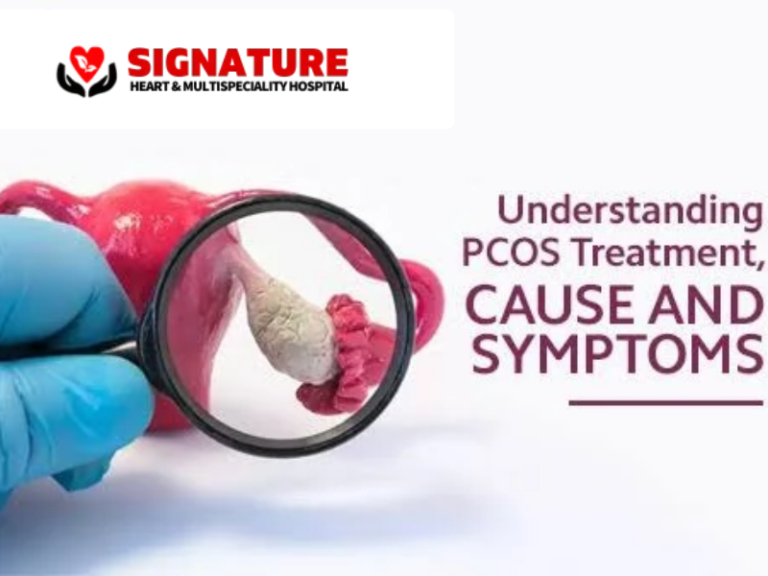 PCOS treatment in Yamuna Vihar